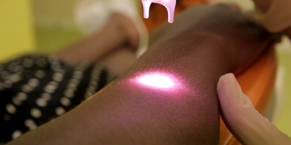 Épilation pour tout type de peau (QOOL-epilation®)