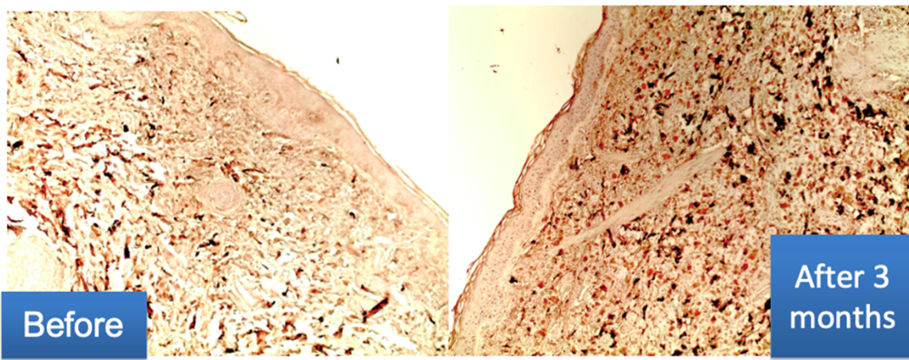 Examen immunohistochimique