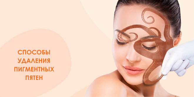 Пигментация : что знать, чтобы её победить ?