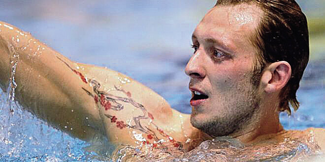 Прощай, прошлая жизнь ! Лазерное удаление татуировок