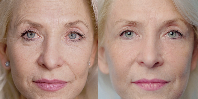 RecoSMA : бьюти-интенсив